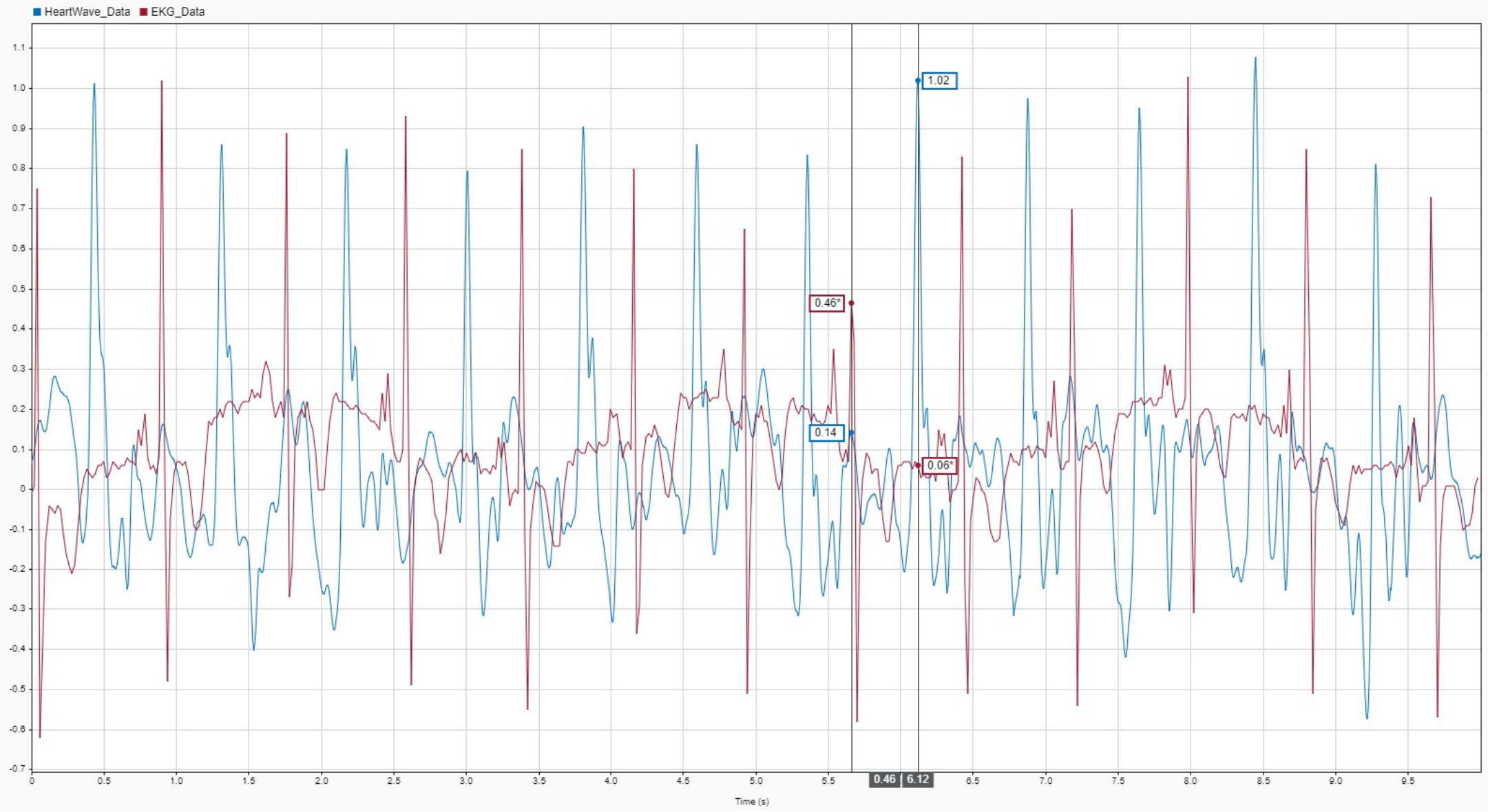 Interposed ECG and Sensor Head Signal