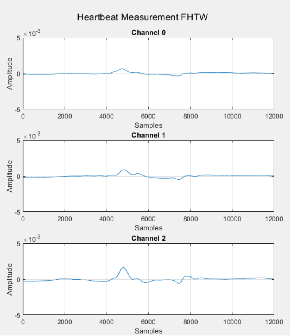 Heartbeat measurement data over time, seperated by channel