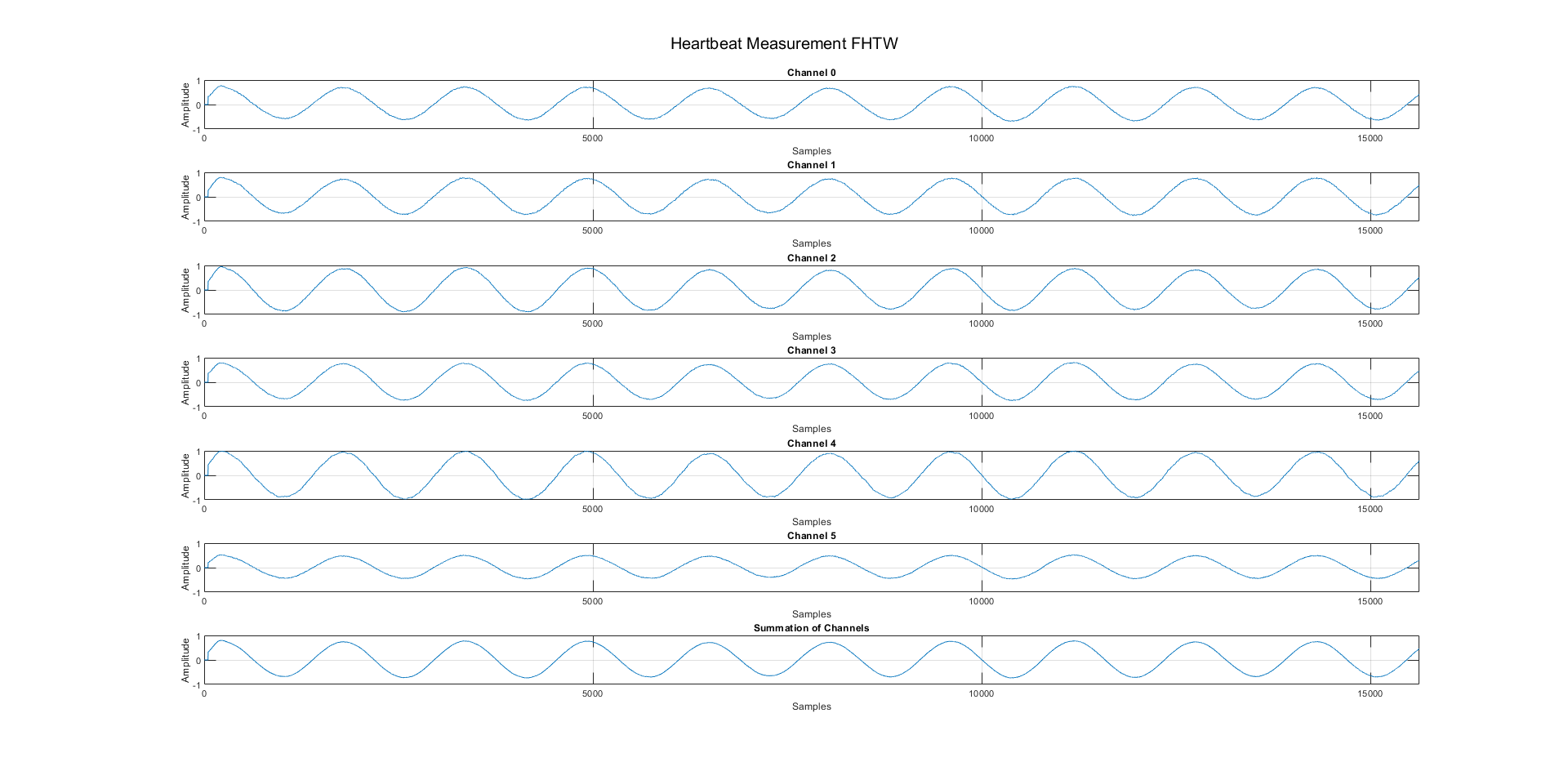 Phantom Test with Sine Wave Position 1